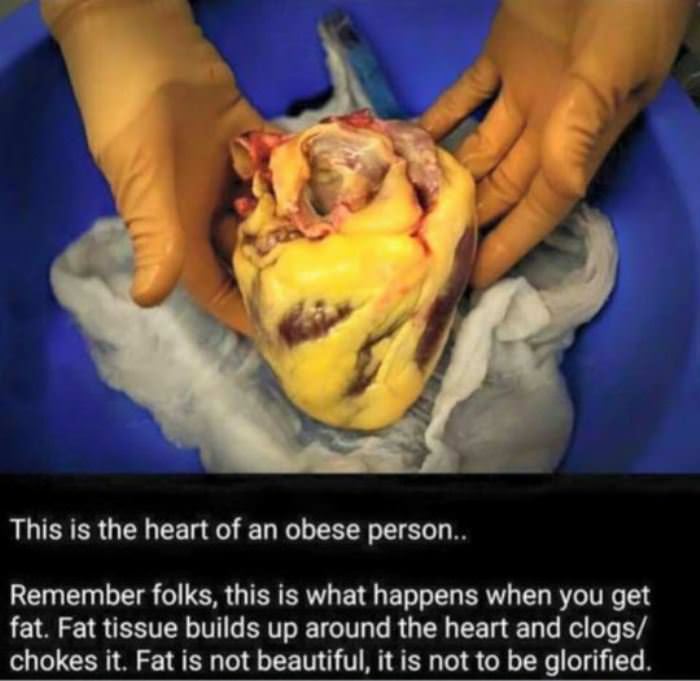 Heart With Fat 99