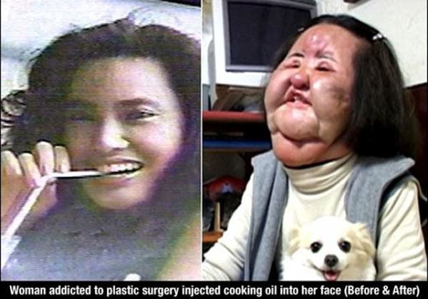 Plastic Surgery Addict funny picture