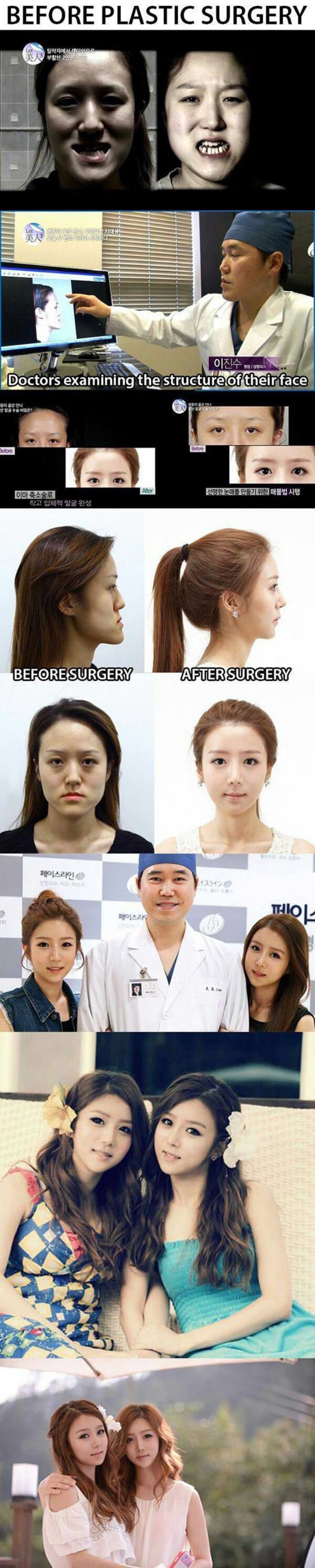 some plastic surgery funny picture