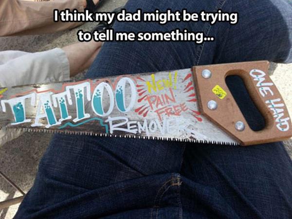 Cheap_Tattoo_Removal_funny_picture