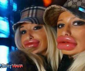 Fatty Fat Lips