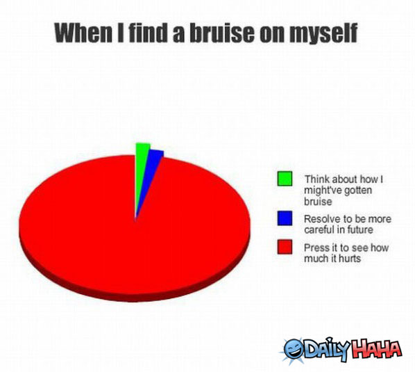 A Bruise funny picture