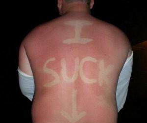 I Suck Sunburn Pic