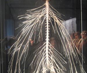 nervous system funny picture