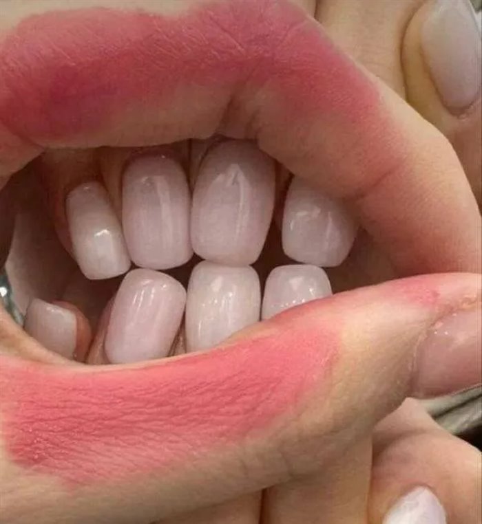 new teeth
