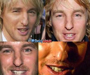 Owen Wilsons Nose