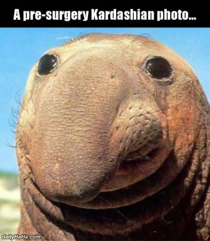 pre surgery kardashian photo funny picture