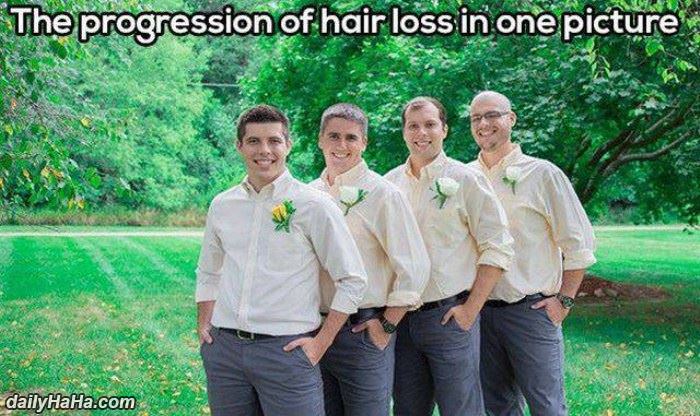 progression of hair loss funny picture