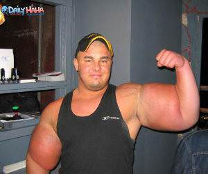 Roids Arm