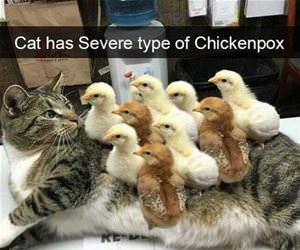 severe case of chickenpox funny picture