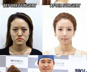 some plastic surgery funny picture