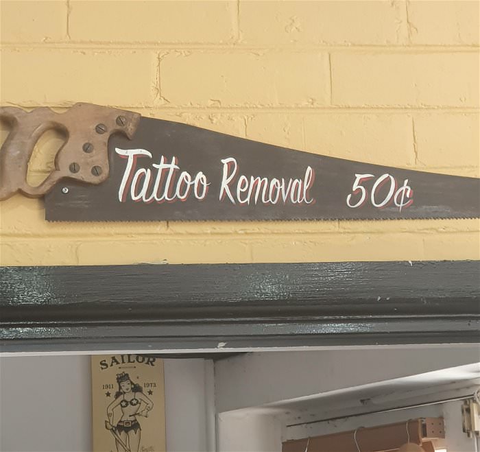 special tattoo removal