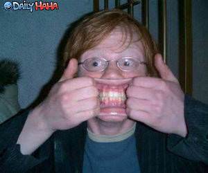 Stretchy Mouth Funny Picture