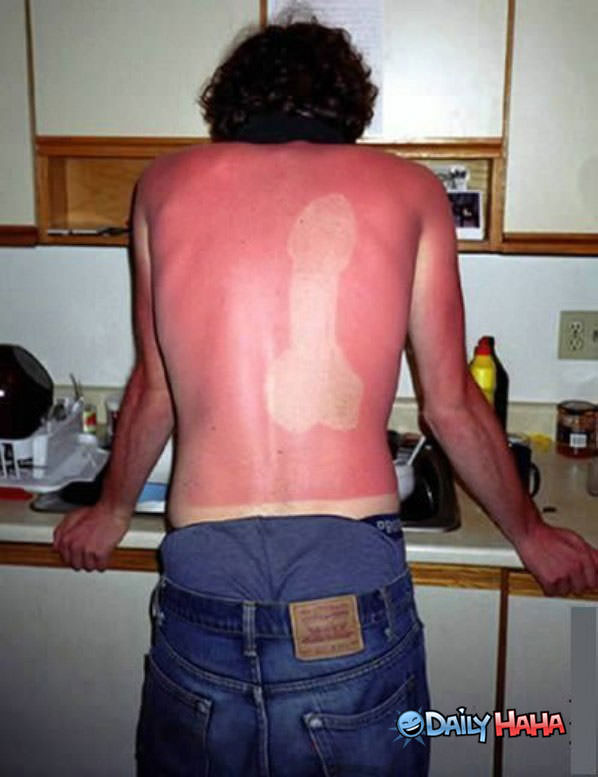 Sunburn Prank funny picture