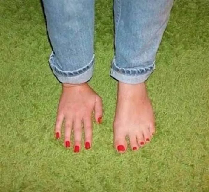 weirdo foot