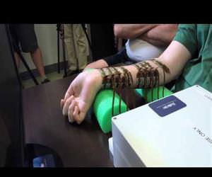 Paralyzed man moves his hand controlled by his own brain for the first time Funny Video