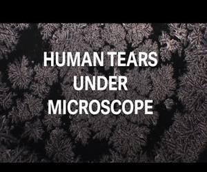 human tears under microscope Funny Video